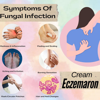 Eczemaron Anti-Fungal & Itch Relief Spray | 100% Safe | Buy 1 Get 1 FREE 🔥🔥